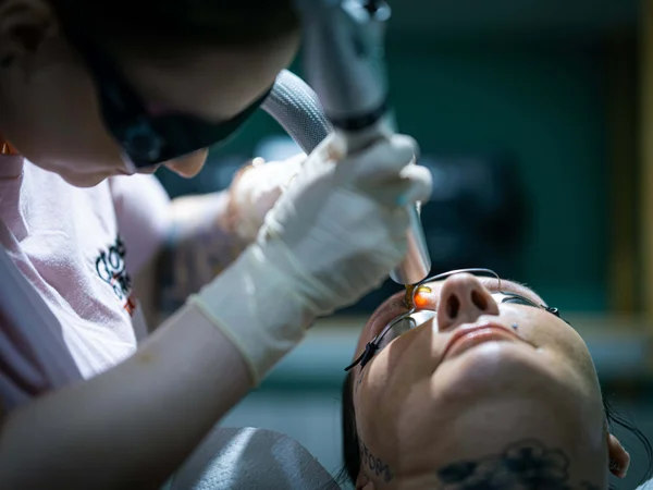 Precision laser treatment of microbladed eyebrows with protective eye shields in place